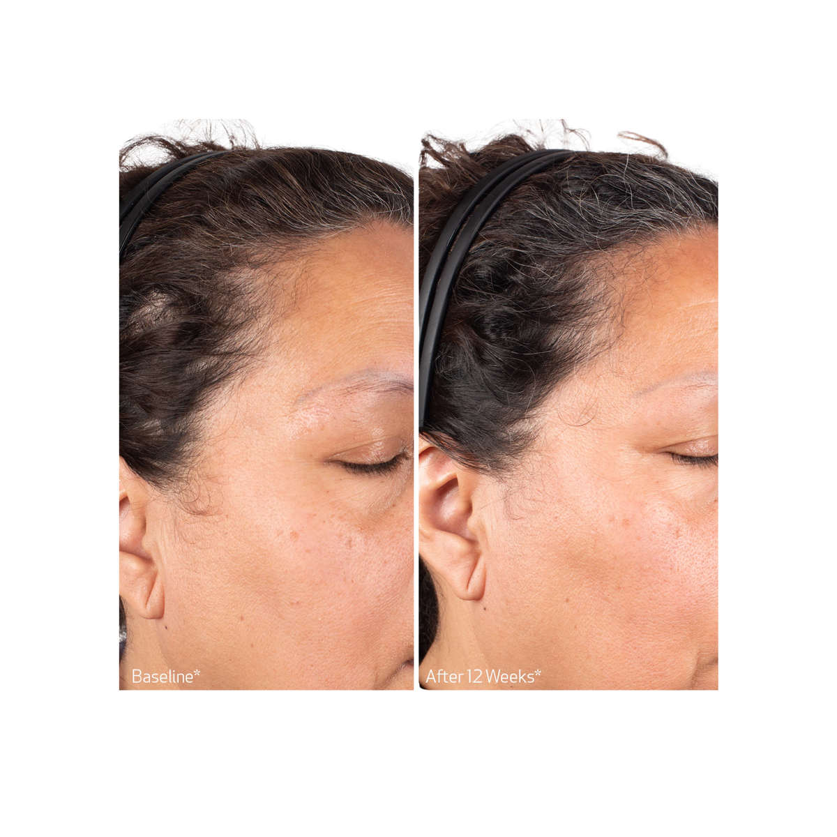 OBAGI - Biostim Scalp Serum
