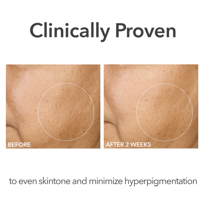DR DENNIS GROSS - Alpha Beta Universal Peel Pads
